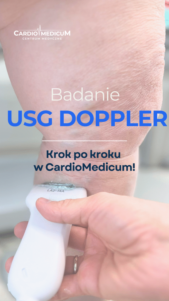 Przebieg badania USG Doppler żył kończyn dolnych w CardioMedicum Kraków